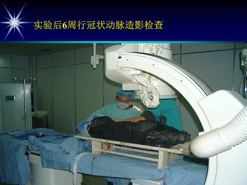 071719155638_01999-08-16激光基因心肌血运重建术_37.jpg