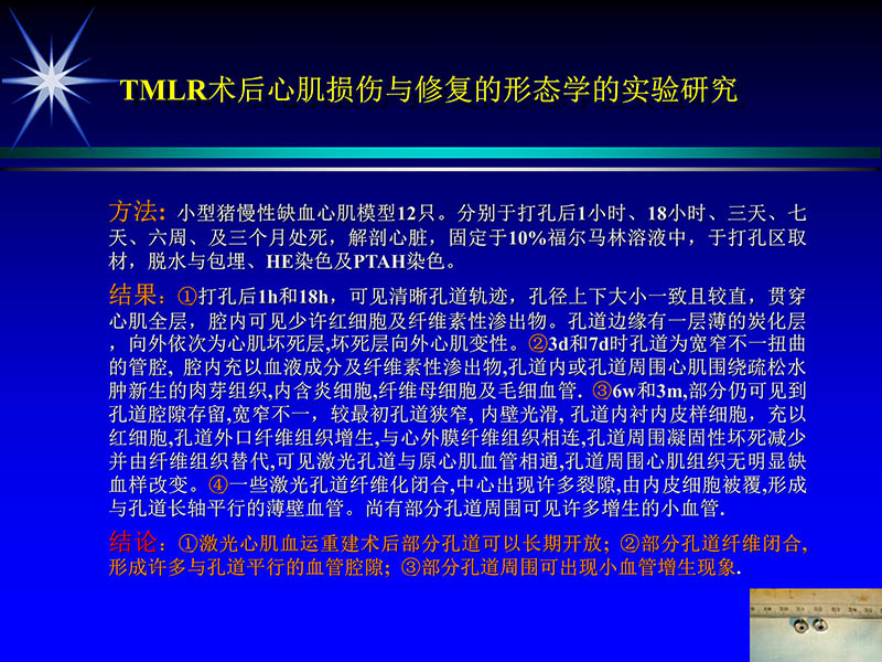 071719234773_02000-11-21激光在心脏外科的应用_59.jpg