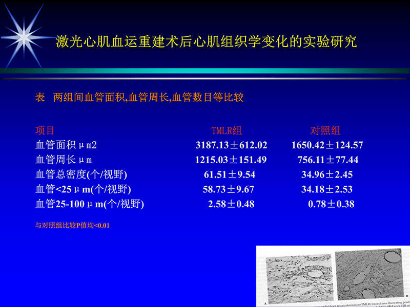 071719234773_02000-11-21激光在心脏外科的应用_60.jpg