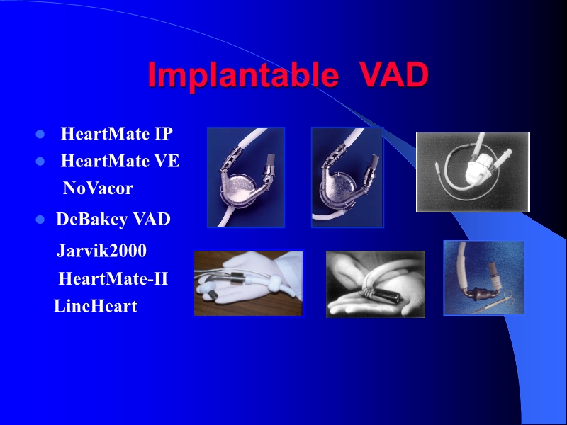 071813452002_0reatingHeartFailurewithVentricularAssistDevice_19.jpg