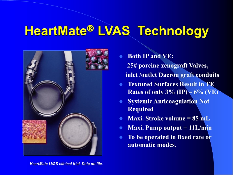 071813452002_0reatingHeartFailurewithVentricularAssistDevice_21.jpg