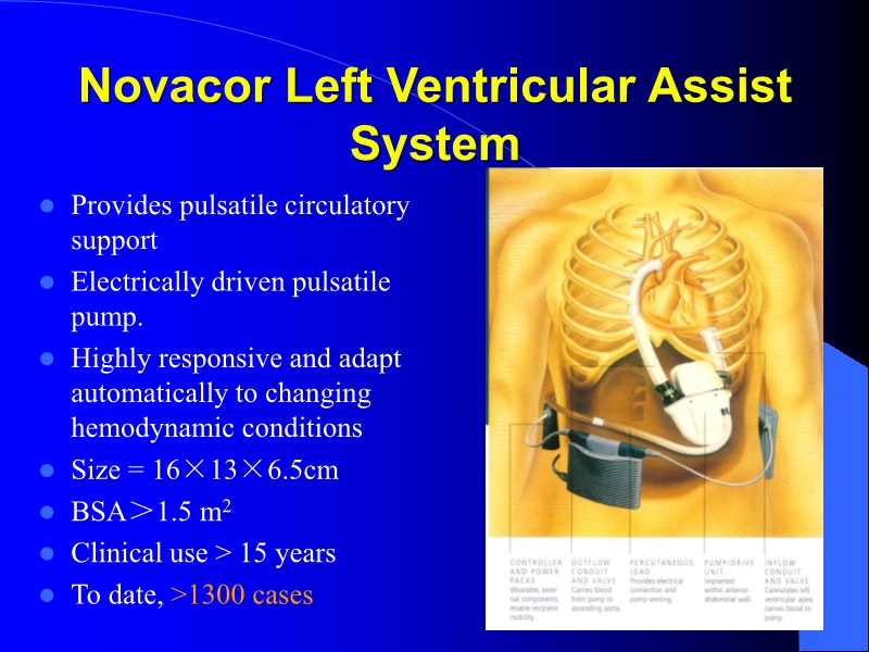 071813452002_0reatingHeartFailurewithVentricularAssistDevice_25.jpg