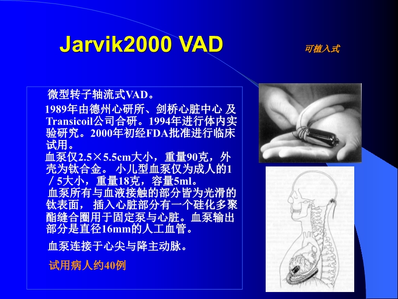 071813452002_0reatingHeartFailurewithVentricularAssistDevice_31.jpg