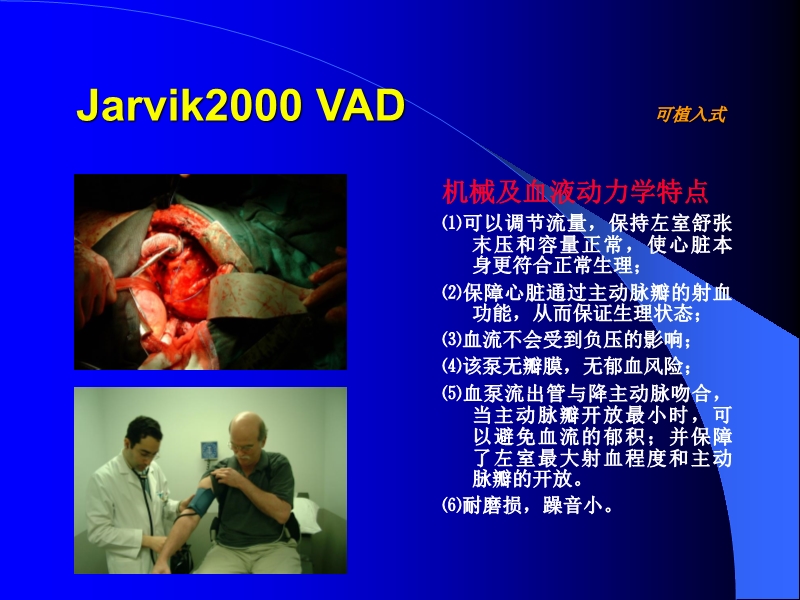 071813452002_0reatingHeartFailurewithVentricularAssistDevice_32.jpg