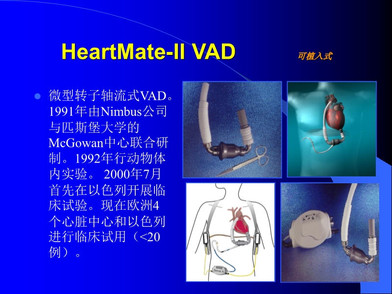 071813452002_0reatingHeartFailurewithVentricularAssistDevice_33.jpg