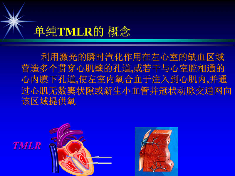 071813461818_02002-10-13激光在心血管疾病治疗中的应用_9.jpg