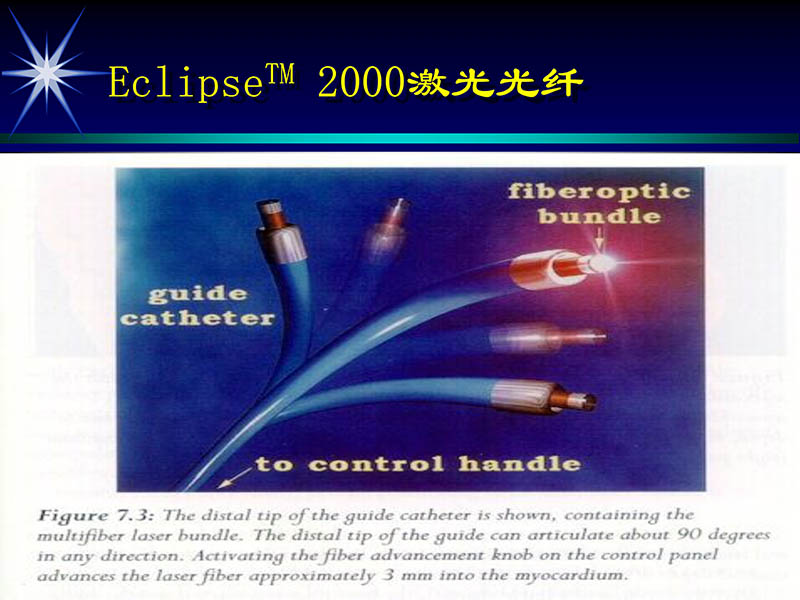 071813461818_02002-10-13激光在心血管疾病治疗中的应用_16.jpg