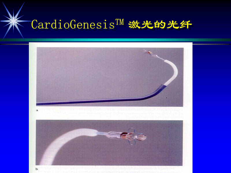 071813461818_02002-10-13激光在心血管疾病治疗中的应用_18.jpg