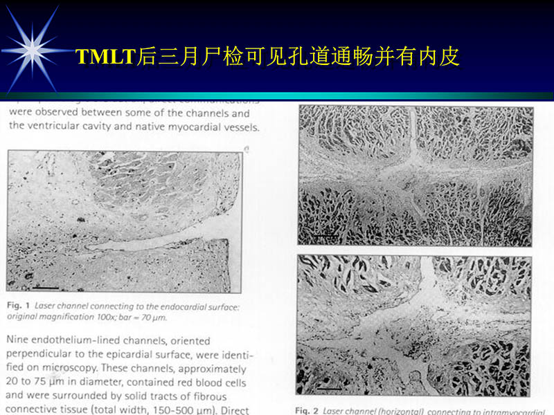 071813461818_02002-10-13激光在心血管疾病治疗中的应用_47.jpg
