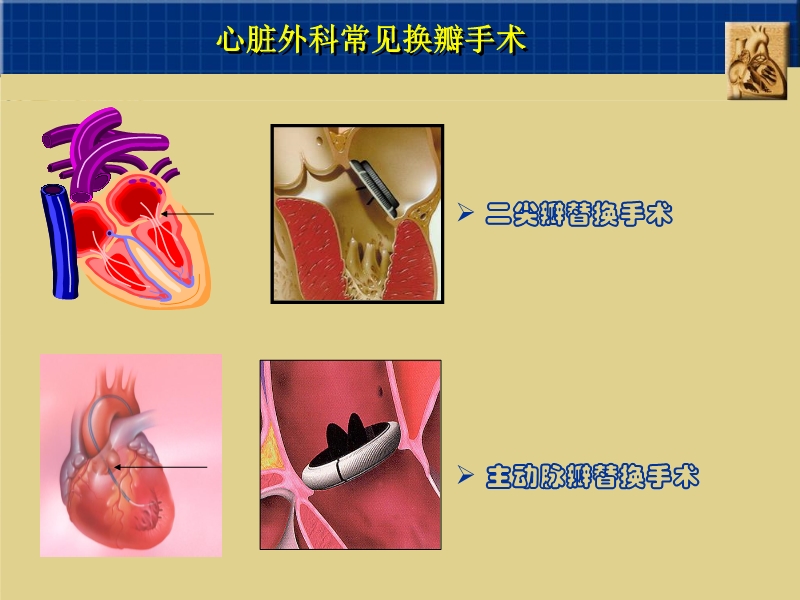 071815262047_02003-12-23心脏外科技术与时俱进_7.jpg