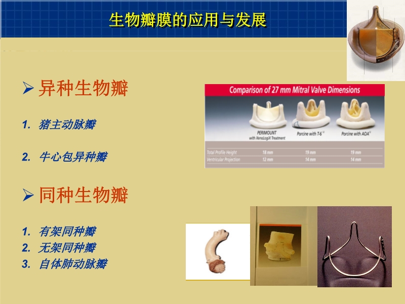 071815262047_02003-12-23心脏外科技术与时俱进_9.jpg