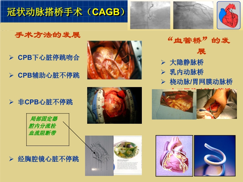 071815262047_02003-12-23心脏外科技术与时俱进_10.jpg