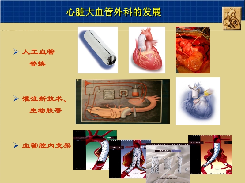 071815262047_02003-12-23心脏外科技术与时俱进_11.jpg