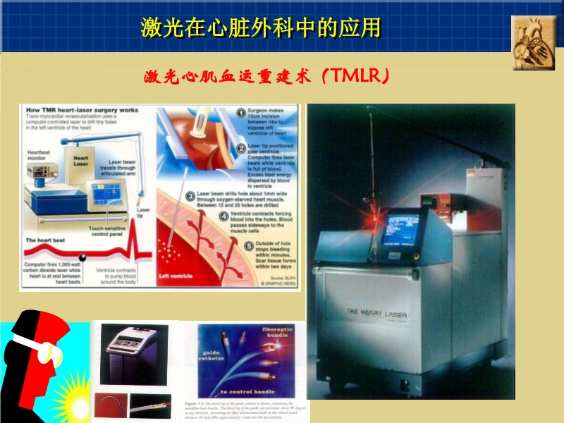 071815262047_02003-12-23心脏外科技术与时俱进_13.jpg