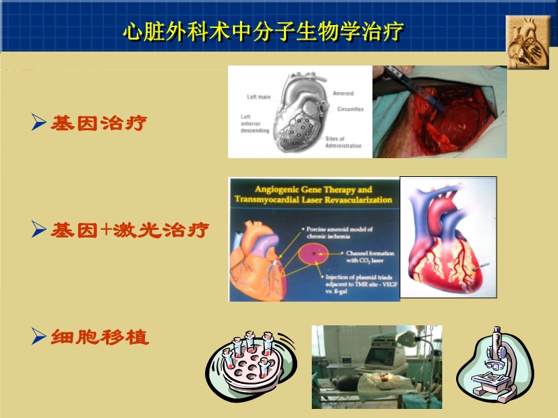 071815262047_02003-12-23心脏外科技术与时俱进_15.jpg