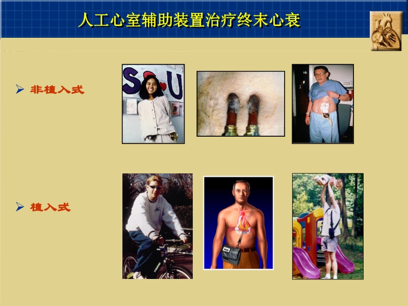 071815262047_02003-12-23心脏外科技术与时俱进_16.jpg