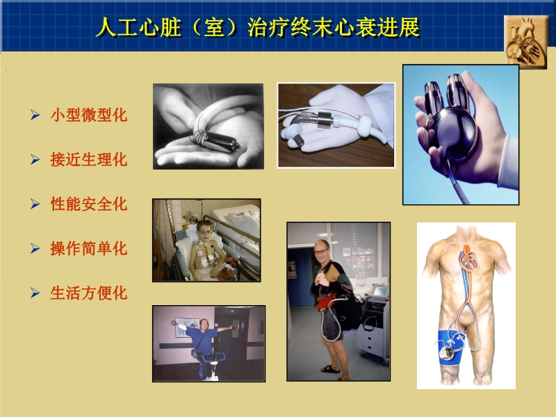 071815262047_02003-12-23心脏外科技术与时俱进_17.jpg