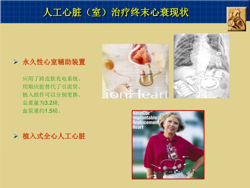 071815262047_02003-12-23心脏外科技术与时俱进_18.jpg