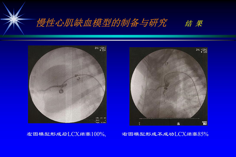 071815272322_02003-12-30vegf基因联合激光心肌血运重建的研究_8.jpg