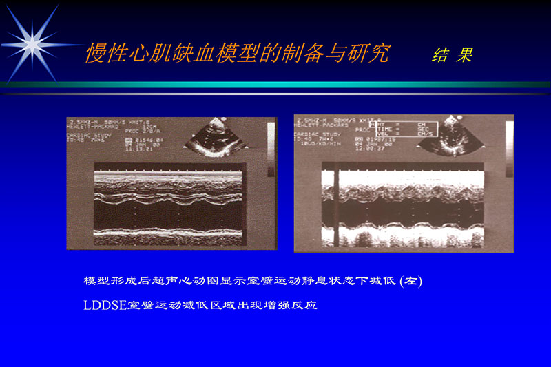 071815272322_02003-12-30vegf基因联合激光心肌血运重建的研究_9.jpg