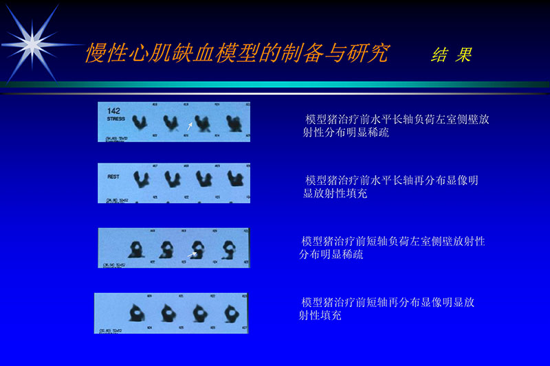 071815272322_02003-12-30vegf基因联合激光心肌血运重建的研究_10.jpg