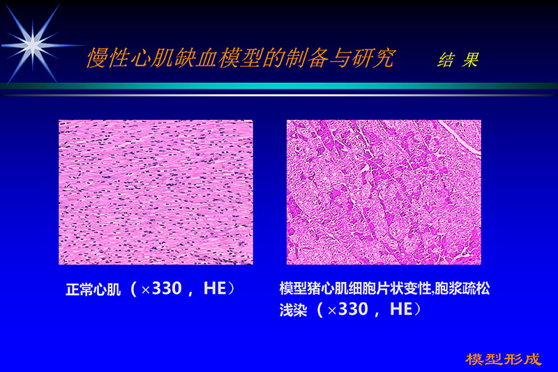 071815272322_02003-12-30vegf基因联合激光心肌血运重建的研究_11.jpg