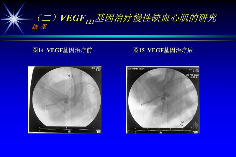 071815272322_02003-12-30vegf基因联合激光心肌血运重建的研究_23.jpg