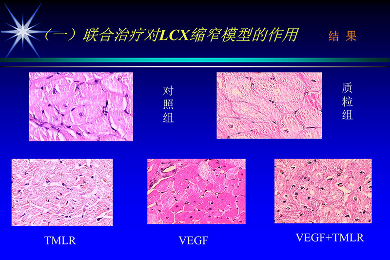 071815272322_02003-12-30vegf基因联合激光心肌血运重建的研究_38.jpg