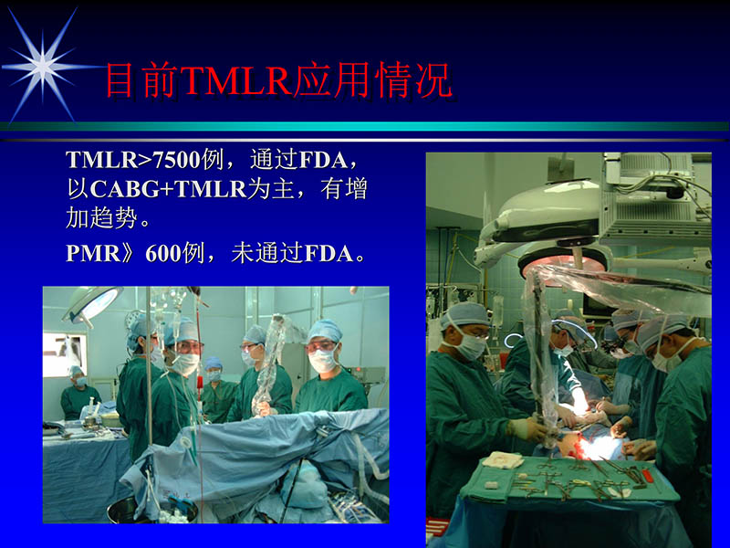 071815311003_02004-06-15激光直接心肌血运重建治疗冠心病_18.jpg