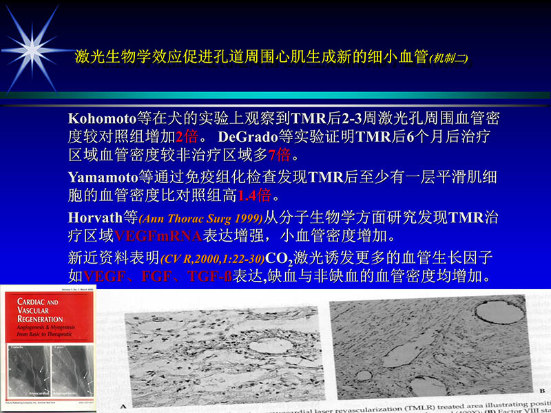 071815311003_02004-06-15激光直接心肌血运重建治疗冠心病_30.jpg
