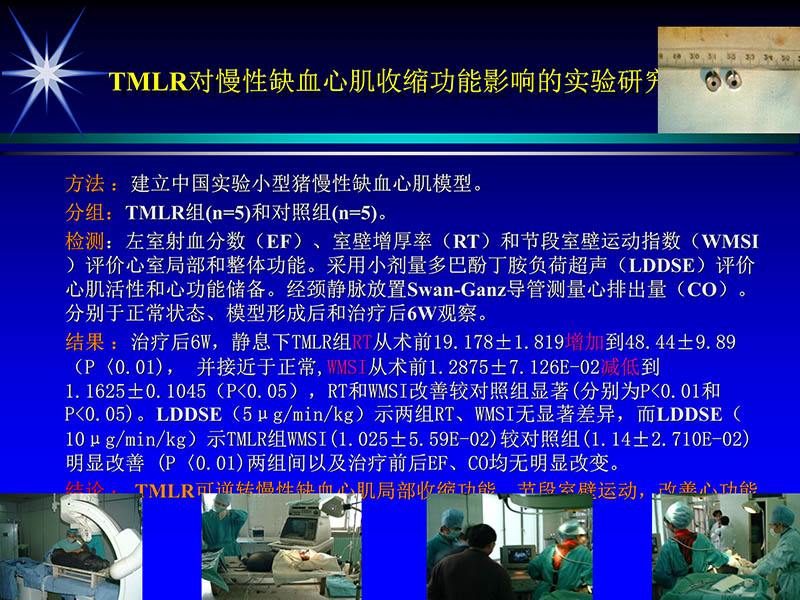 071815311003_02004-06-15激光直接心肌血运重建治疗冠心病_56.jpg