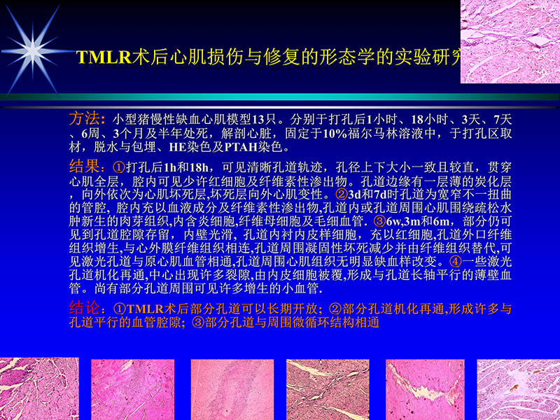 071815311003_02004-06-15激光直接心肌血运重建治疗冠心病_57.jpg