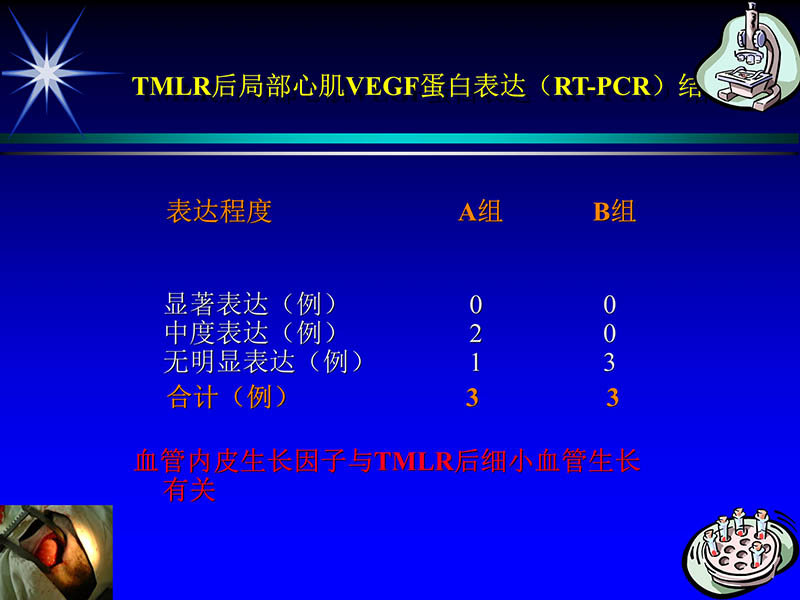 071815311003_02004-06-15激光直接心肌血运重建治疗冠心病_59.jpg