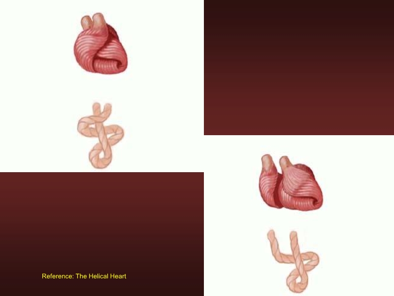 071816214728_0urrentSurgeryApproachestoEnd-stageHeartFailure_7.jpg