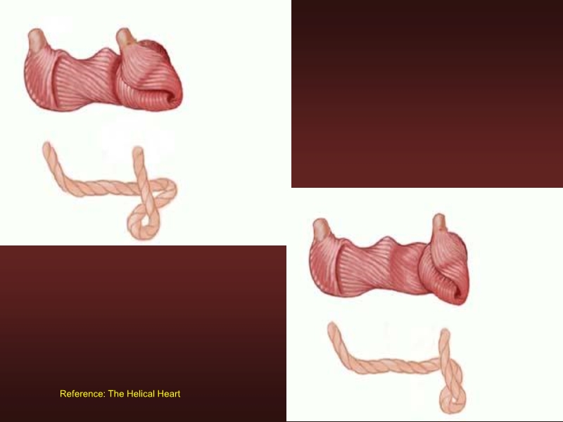 071816214728_0urrentSurgeryApproachestoEnd-stageHeartFailure_8.jpg