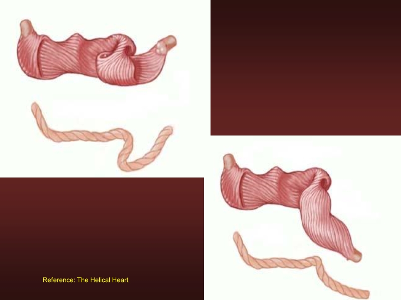071816214728_0urrentSurgeryApproachestoEnd-stageHeartFailure_9.jpg