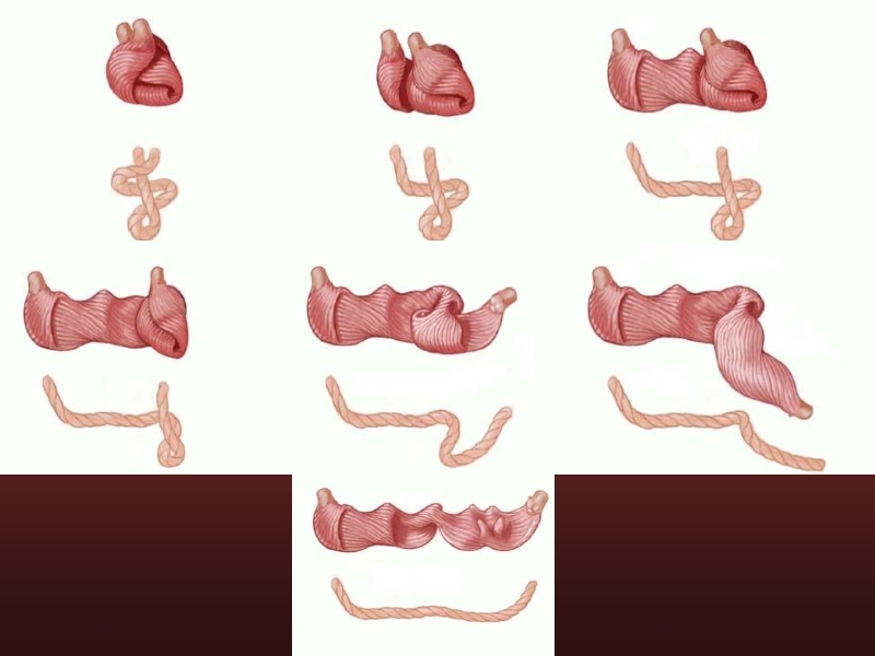 071816214728_0urrentSurgeryApproachestoEnd-stageHeartFailure_10.jpg
