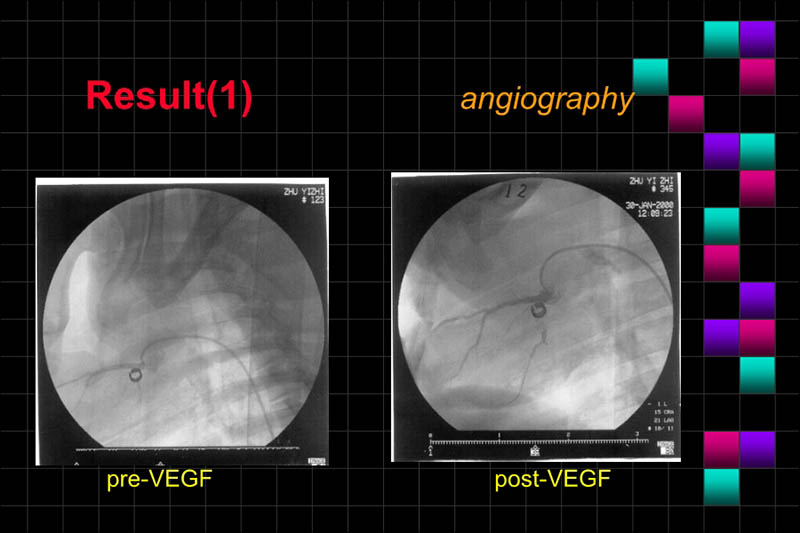071816283803_0ONOFTMLRANDVEGFGENETHERAPYISCHEMICPORCINEHEART_9.jpg