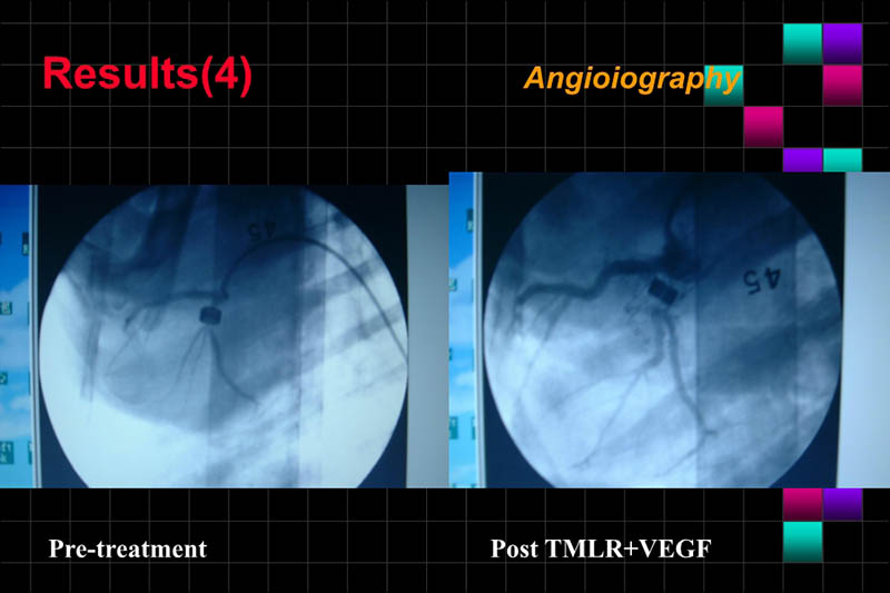 071816283803_0ONOFTMLRANDVEGFGENETHERAPYISCHEMICPORCINEHEART_12.jpg