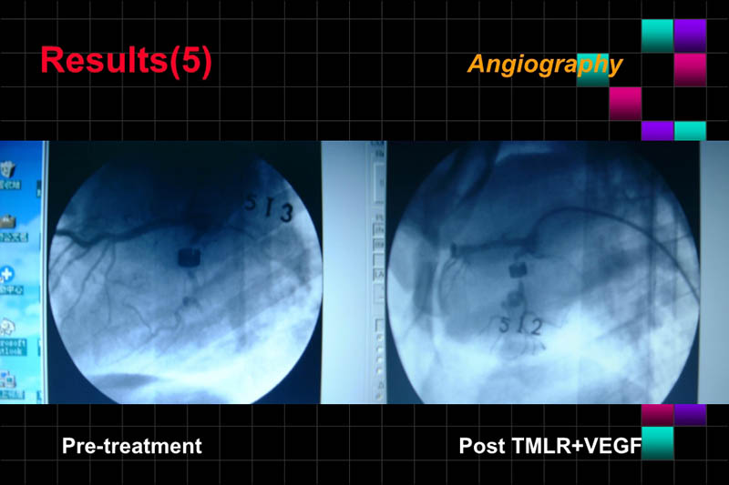 071816283803_0ONOFTMLRANDVEGFGENETHERAPYISCHEMICPORCINEHEART_13.jpg