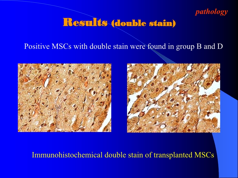 071816404016_0ellsWithTMLRforTreatingAcuteMyocardialIschemia_10.jpg