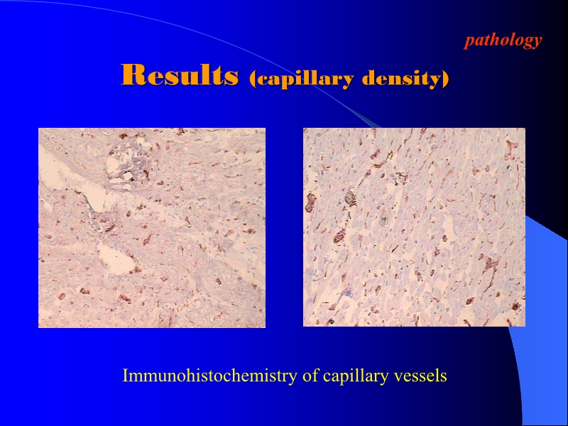 071816404016_0ellsWithTMLRforTreatingAcuteMyocardialIschemia_11.jpg