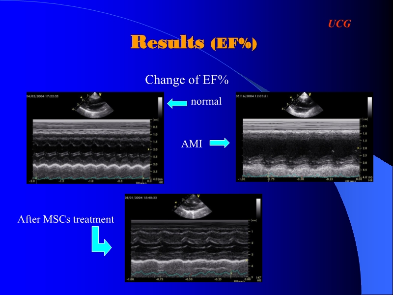 071816404016_0ellsWithTMLRforTreatingAcuteMyocardialIschemia_13.jpg