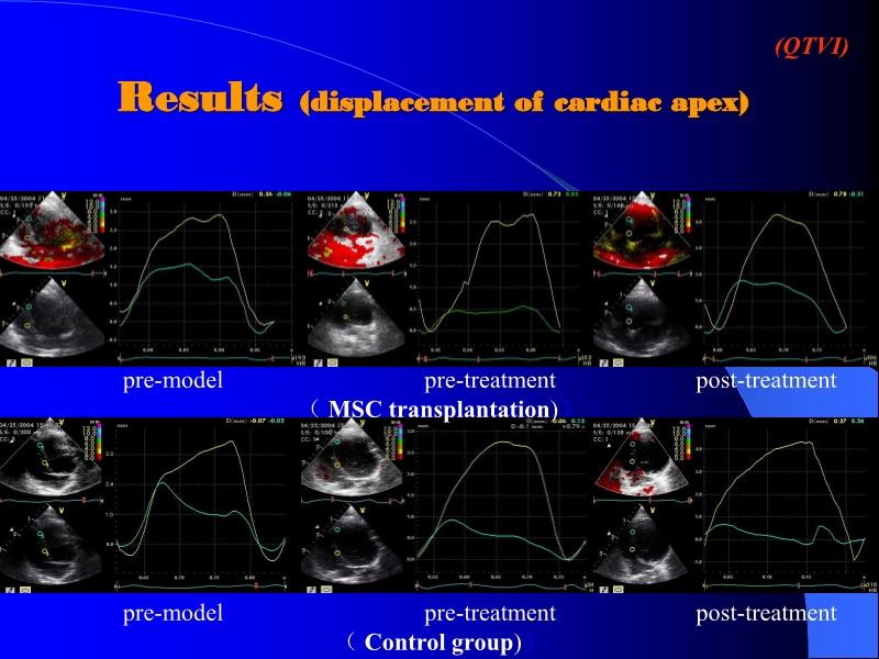 071816404016_0ellsWithTMLRforTreatingAcuteMyocardialIschemia_15.jpg