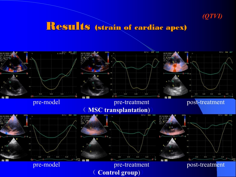 071816404016_0ellsWithTMLRforTreatingAcuteMyocardialIschemia_17.jpg