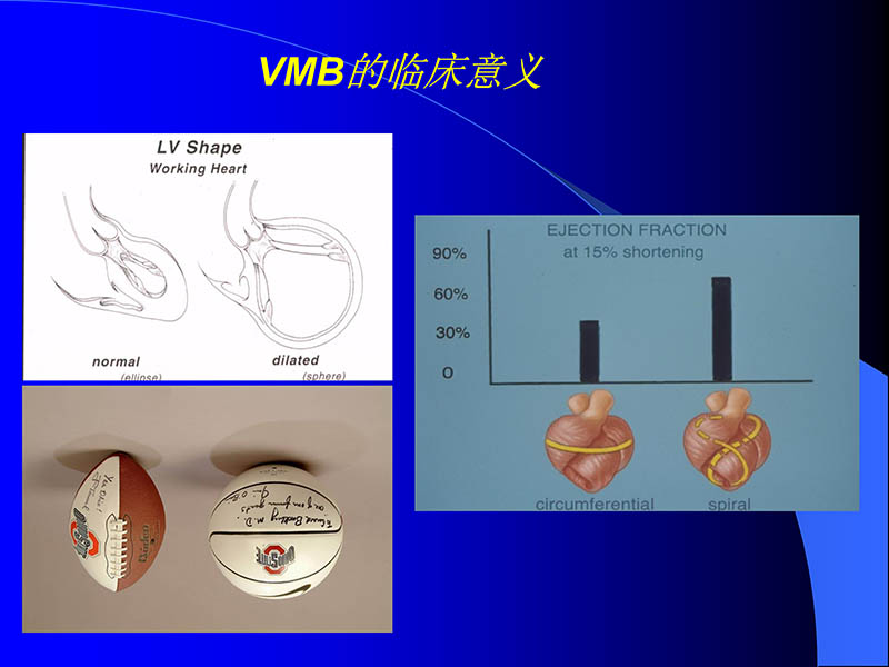 071816413472_02005-08-18现代人工心室装置治疗心衰临床应用_10.jpg