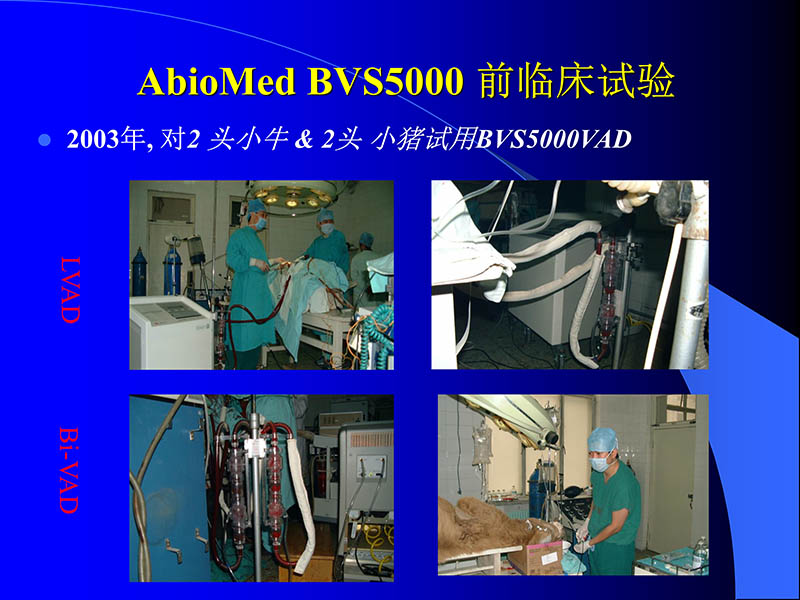 071816413472_02005-08-18现代人工心室装置治疗心衰临床应用_72.jpg
