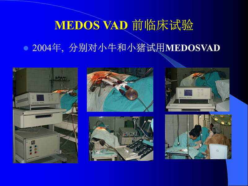 071816413472_02005-08-18现代人工心室装置治疗心衰临床应用_73.jpg