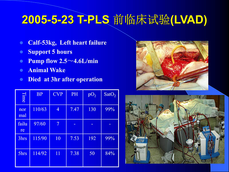 071816413472_02005-08-18现代人工心室装置治疗心衰临床应用_74.jpg