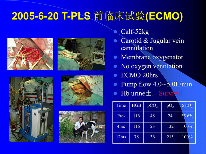071816413472_02005-08-18现代人工心室装置治疗心衰临床应用_75.jpg